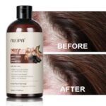 NUSPA Anti Hair Loss Shampoo - Image 5